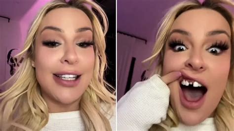 tana tooth|tana mongeau teeth.